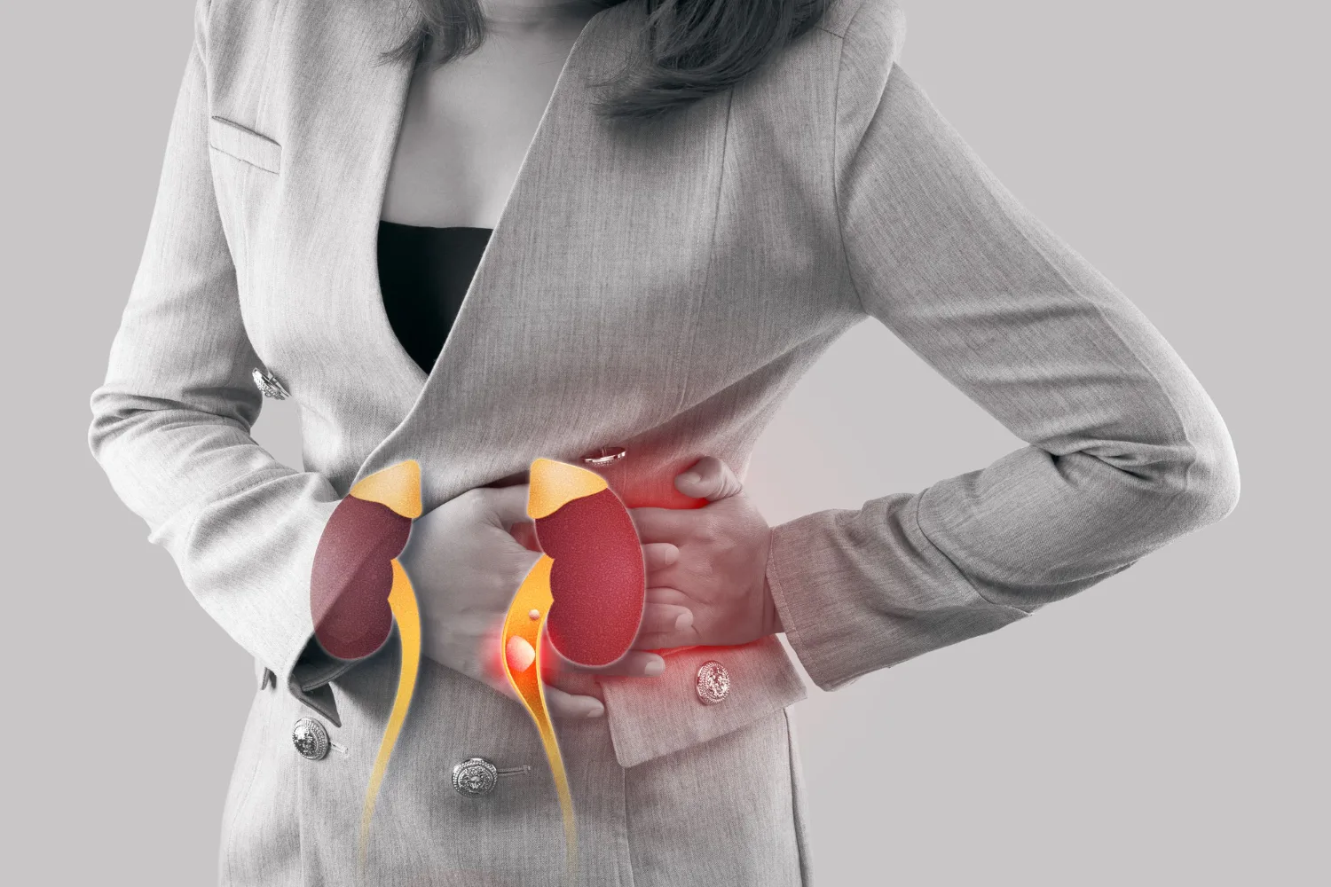 Enfermedad renal crónica